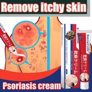 Ekzema Psoriasis Kurap Gatal Kulit Ubat Krim Herba Cina Eczema Psoriasis Beriberi Fungus