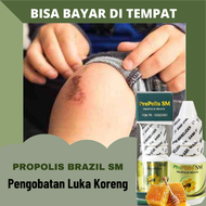 Obat Luka Korengan Di Lutut - Luka Jatuh Luka Gores Luka Jatuh Kecelakaan Bekas Luka Jatuh Luka Baka