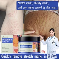 Stretch Mark Cream Effective Permanent Stretch Mark Removal Stretch Mark & Obesity Mark Removal 120g