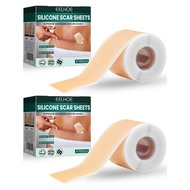 Silicone Scar Sheets แผ่นซิลิโคนแปะแผลเป็น กันน้ำ ใช้ซ้ำได้ รอยแผลเป็นจากสิวแผลผ่าตัดแผลไหม้ ใสไร้กล