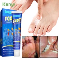 ubat kulat kaki ubat kaki Kaki mengelupas Kulat air Kaki gatal berbau Foot fungus Sumifun beriberi i