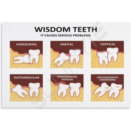 Dental Clinic Wisdom1 Tooth Poster (3) Canvas for Bedroom Living Room Decor 12x08inch(30x20cm) Unfra