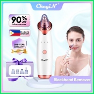 ℗ ◬ ◳    【Local Delivery】 CkeyiN pimple remover Vacuum Blackhead Remover whiteheads remover tool wi