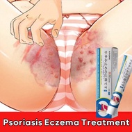 Antibacterial Ekzema Cream ubat gatal kulit ubat herba cina gatal krim gatal kulit herba cina obat g