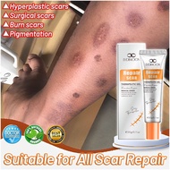 LYDIMOON Scar Removal Gel Cream 20g Keloid Scar Removal Scar Gel Repair Old Black Scars-Acne Scar-St