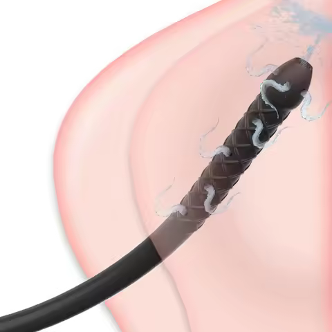 Porous Silicone Enema Douche: Flexible, Extra - Long for Backyard Cleansing & Play, Unlock New Pleas