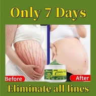 ✻  Scar Removal Cream Body Eliminate Stretch Marks Repair Surgical Burn Old Scars Gel Firm Belly Butt Liftt Oil 7 Days Skin Care