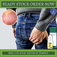 Obat Gatal Di Pantat, Obat Penghilang Koreng di Pantat, Gatal di Bokong, Gatal Pantat Dan Selangkang