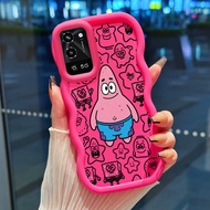 Casing For OPPO A56 5G Case Casing Protective Silicone HP Casing Starfish Pattern Pentagonal Casing 