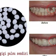 Gel penambal gigi bolong/pembuat gigi palsu/ lem gigi palsu/ DL