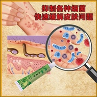 Wet Detoxifying Ointment Remove Itching Whole Body Dry Itching Legs Skin Itching Anti-Itching Anti-I