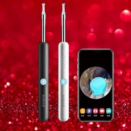 Smart Visual Ear Sticks Ear Cleaner Endoscope 300W High Precision Earpick Mini Camera Otoscope