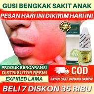 Obat Gusi Bengkak Sakit Untuk Anak Gusi Bernanah Anak Gusi Berdarah Anak Polip Gusi Anak Radang Gusi