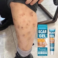 Krim hilangkan parut hitam krim hilangkan parut hitam Scar Removal Cream ubat hilangkan parut stretc