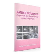 Kanser Payudara: Pengesanan dan Diagnosis Awal Melalui Pengimeja