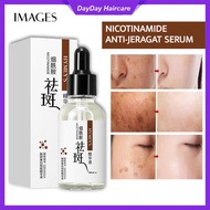 IMAGES / HYMEY’S Anti Freckles Whitening Serum Niacinamide Jeragat Muka Melasma Skin Lightening 30ml