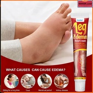 【Fast Effective 】Leg Edema Cream Leg Care Foot Cream Natural Herbal Reduce Aqueous Edema Relief Join