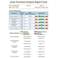 QMR-998 Quantum Resonance Magnetic Analyzer Set Hand Touch Quantum Body Analyzer with 52 Reports 10T