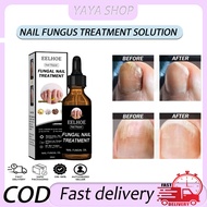 Eelhoe Nail Repair Solution Antibacerial Nail Cleaning Repair Liquid Anti Onychomycosis Paronychia N