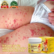 Eczema Psoriasis Ointment antibacterial anti-itch cream Dermatitis cream Antibacterial, anti-pruritic and fungal-inhibiting Safe Non irritating