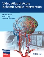 Video Atlas of Acute Ischemic Stroke Intervention Maxim Mokin