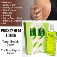Toner Bedak Sejuk Cooling Prickly Heat Lotion/ Jerawat Muka Badan/ Badan Panas Ruam Gatal/ Sunburn/ 