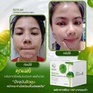 SERUM CENTELLA ASIATICA 98%