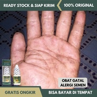 Obat Alergi Semen, Obat Gatal Alergi Semen, Obat Salep Alergi Semen