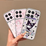 honor x6a case honor x6b x6c case Leather Anti fall protective phone case