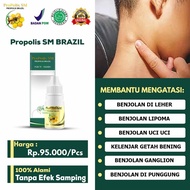 Obat Benjolan Lipoma - Obat Pengempes Benjolan Lemak Obat Alami Benjolan Lipoma Obat Penghilang Lipo