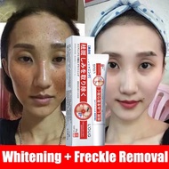 Japan Whitening Blemish Flek Hitam Penghilang Flek Hitam Original Magic Glow Cream Anti Freckle Sale