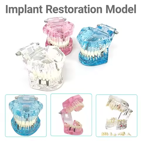 Dental Removable Teeth Models Dental Implant And Restoration Model Teeth Implant Restoration Bridge 