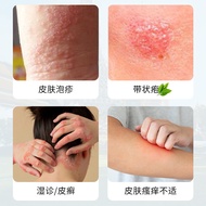 9 ️ ⃣ Snake Discount External Care Ointment Skin Itchy Skin Discomfort Relieve Skin Rash External Ca