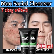Facial Foam For Men Cleanser Jerawat Pencuci Muka Lelak Pencuci Muka Lelaki Oil Control Mild Moistur