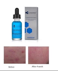 順豐包郵  升級版 Cosmetic skin solutions CSS 藍銅胜肽防敏嫩膚精華 Copper Peptide Serum 30ml