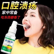正货100%★[15,000 people ship within 2 hours] Oral ulcer ulcer spray s [1.50,000 people Shipped within 