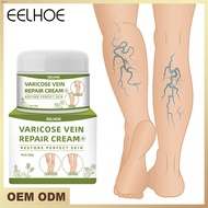 Eelhoe Vein Repair Cream Opens The Veins And Relieves Painful Varicose Leg Bumps Vein Repair Cream 50g -acerver