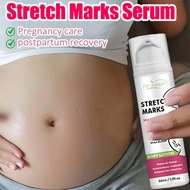 Local seller ✨ Stretch mark cream, stretch mark correction cream, stretch mark removal, obesity mark