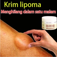 Lipoma Lumps Medicine Lipoma Cream Lipoma Lumps Remover Drug 30g Ganglion Cyst Medicine, Lipoma Lump