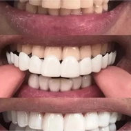 Populer Gigi palsu instan atas bawah