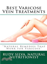 Best Varicose Vein Treatments ― Natural Remedies That Work for Varicose