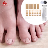 [Sharprepublic] Ingrown Toenail Correction Kit, Ingrown Toenail Correction Patch, Breathable