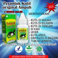 Obat kutil paling ampuh Bersih 2-3 hari - obat penghilang kutil anpiloma asli wajah kelamin muka ket