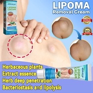 COD Lipoma Removal Cream original lipoma ointment Lump Removal Lipoma Ointment Cream Fat Lump Remova