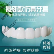 Temporary Denture Braces Eating Artifact Door Braces Missing Denture Braces Teeth Simulation Teeth B