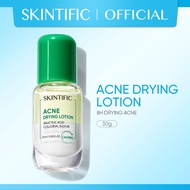 [NEW] SKINTIFIC Acne Drying Lotion Salicylic Acid Acne spot treatmen Acne Scar Serum Essence
