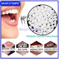 PERMANEN KUAT Penambal gigi ompong patah Gigi palsu penutup ompong depan bawah Temptooth Temporary T