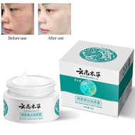 Melasma Cream Whitening Freckle Cream | Remove Pekas & Freckles