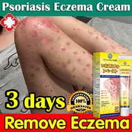 Eczema Psoriasis Cream Japan Sulfur Antibacterial Cream 20g Anti-Itch Cream Dermatitis Cream Antibac