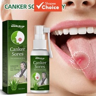 Ulcer Breath Sprays,Mouth Ulcers Repair Spray,Ulcer ,Canker Sore Treatment,Canker Spray,Herbal Mouth